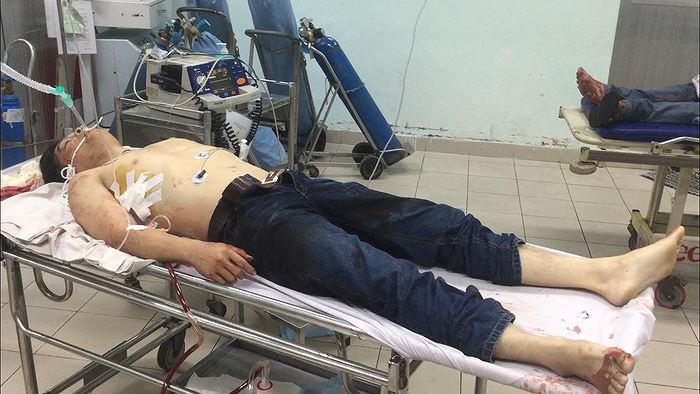 Chấn động khi băng trộm xe SH đâm 5 hiệp sĩ TP.HCM thương vong